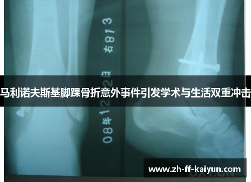 马利诺夫斯基脚踝骨折意外事件引发学术与生活双重冲击 马利诺夫斯基脚踝骨折意外事件引发学术与生活双重冲击